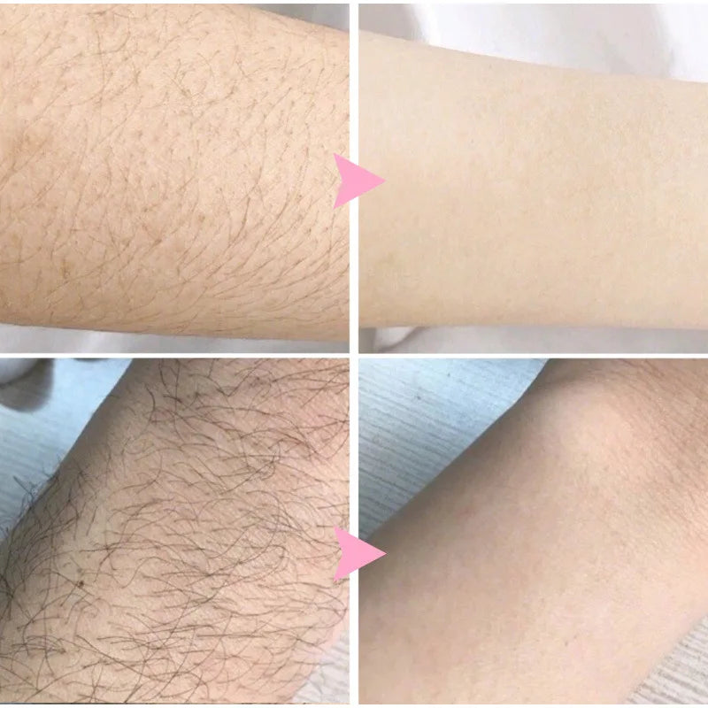 Fast Hair Removal Spray