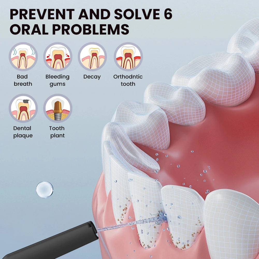 Sejoy Water Dental Flosser